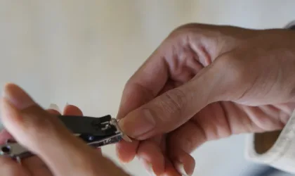 Mycose de l’ongle du pied : quel traitement maison est vraiment efficace ? Mycose de l’ongle du pied : quel traitement maison est vraiment efficace ?
