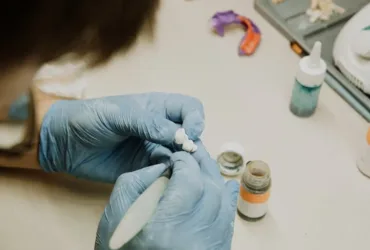 Dents resine capdentaire : quels sont les avantages et la durée de vie ?