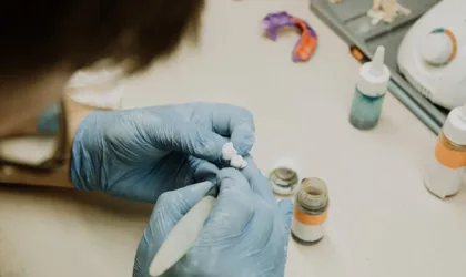Dents resine capdentaire : quels sont les avantages et la durée de vie ?