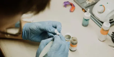 Dents resine capdentaire : quels sont les avantages et la durée de vie ?