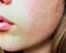 Pourquoi mes pores paraissent-ils plus visibles après certains soins naturels ? Pourquoi mes pores paraissent-ils plus visibles après certains soins naturels ?