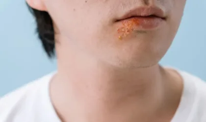 Soigner ampoule pied remède grand-mère : quelles astuces sont les plus efficaces ? Soigner ampoule pied remède grand-mère : quelles astuces sont les plus efficaces ?