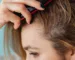 Comment calmer un cuir chevelu qui démange sans produits chimiques ?